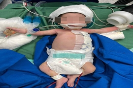 انجام موفقیت‌آمیز عمل جراحی کیست مادرزادی جدار شکم بر روی نوزاد ۱۱ روزه در مرکز آموزشی درمانی 17 شهریور